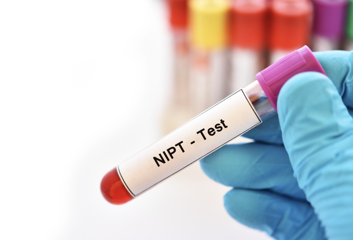 NIPT検査の概要・採血イメージ