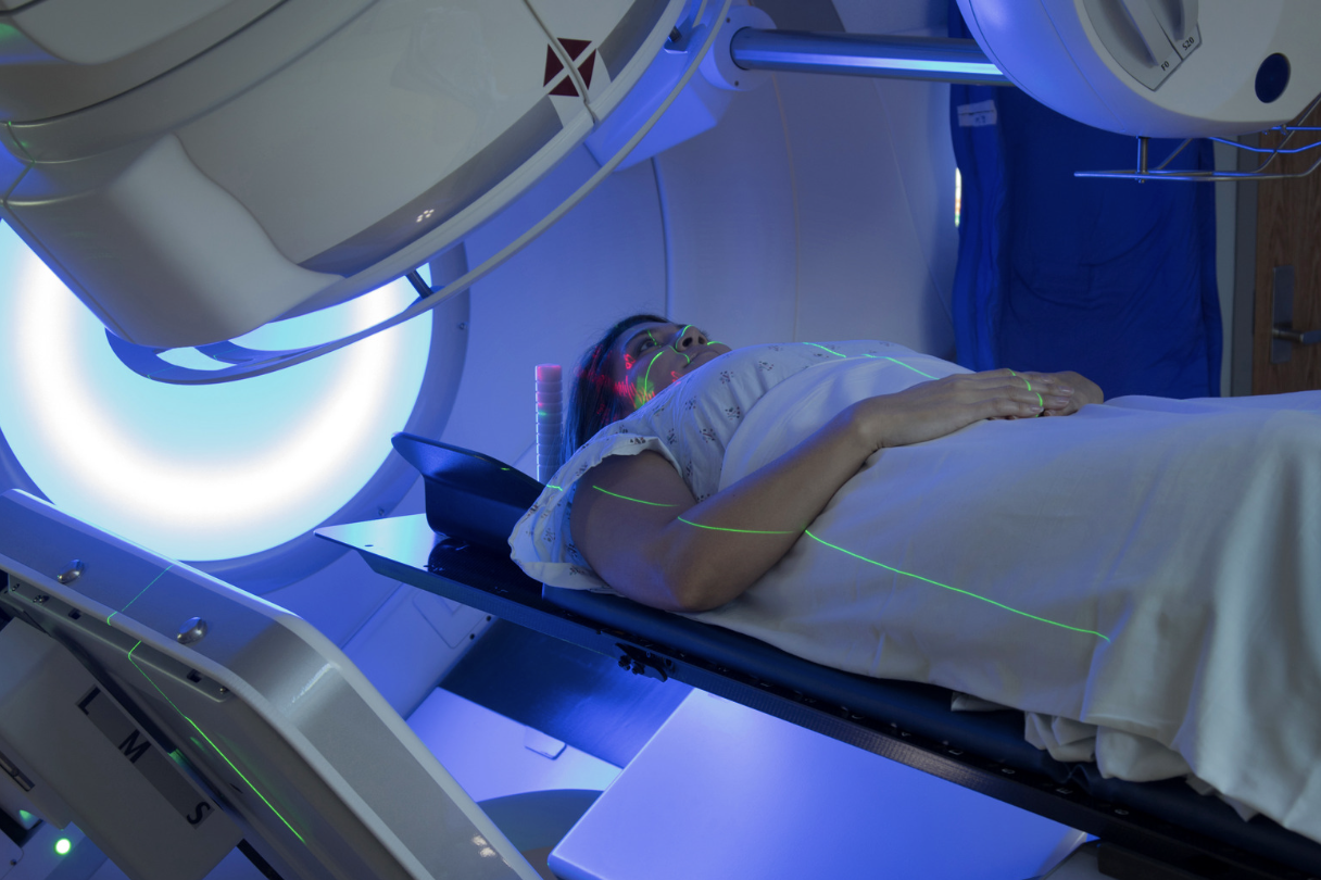IMRT(強度変調放射線治療)で腫瘍に合わせて線量を調整するイメージ