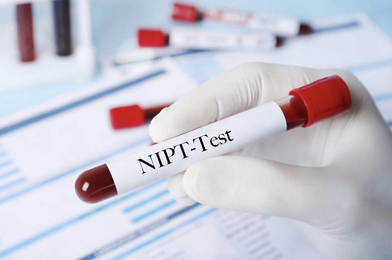 NIPTが解析するのは胎盤由来DNA（cffDNA）のイメージ